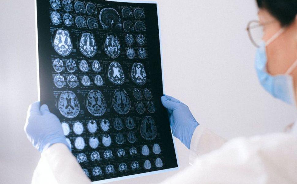 Implant cerebral pentru a trata depresia și paralizia. Proiectul SF devenit realitate
